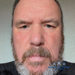 William McKenzie