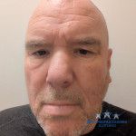 William McKenzie