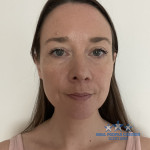 AILEEN HOPE